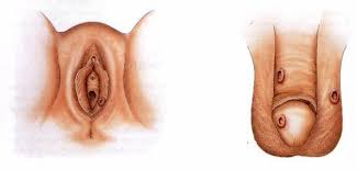 Jual Obat Sipilis De Nature Pengiriman Ke Malaka